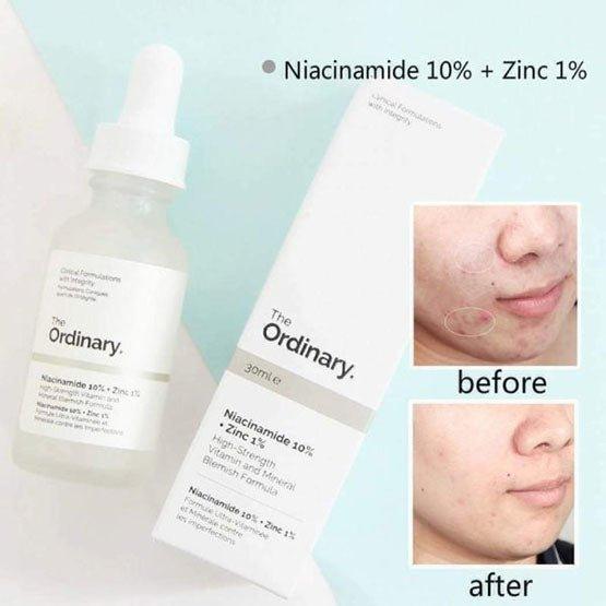 The Ordinary Niacinamide 10% + Zinc 1% (30ml packing)